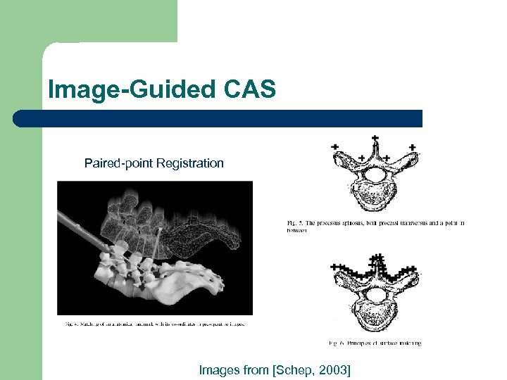 Image-Guided CAS Paired-point Registration Images from [Schep, 2003] 