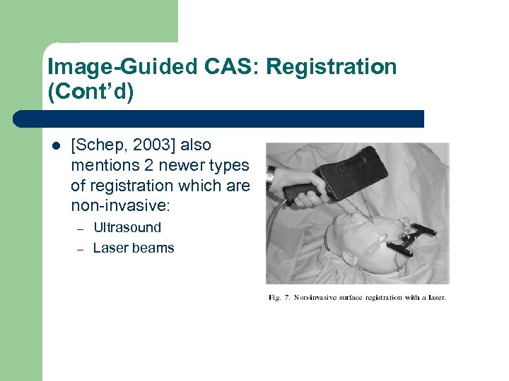 Image-Guided CAS: Registration (Cont’d) l [Schep, 2003] also mentions 2 newer types of registration