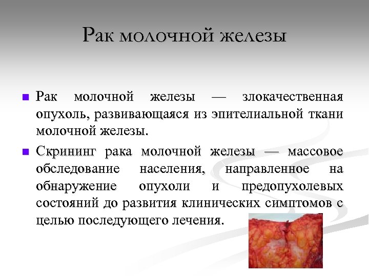 Рак молочной железы n n Рак молочной железы — злокачественная опухоль, развивающаяся из эпителиальной