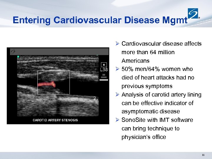 Entering Cardiovascular Disease Mgmt Ø Cardiovascular disease affects more than 64 million Americans Ø