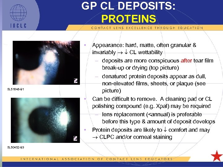 GP CL DEPOSITS: PROTEINS • 5 L 51648 -91 • • 5 L 50452