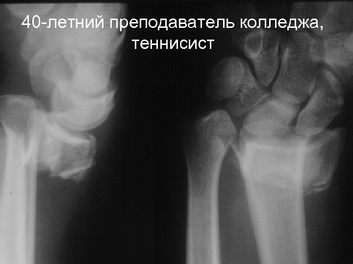 40 -летний преподаватель колледжа, теннисист 