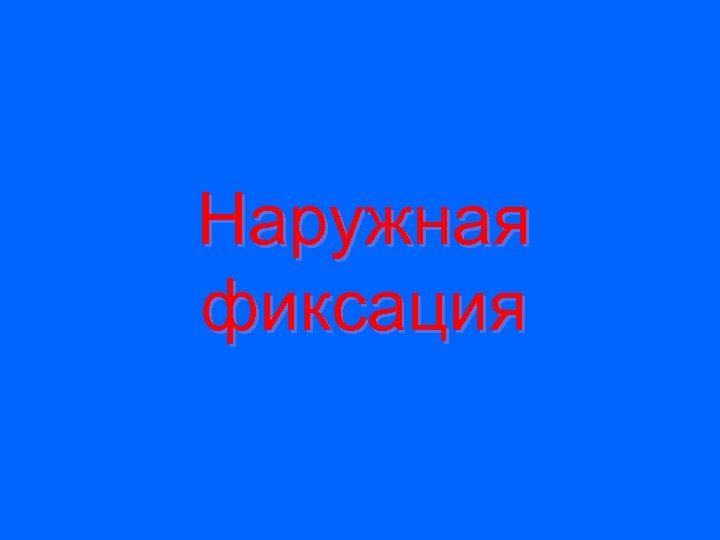 Наружная фиксация 