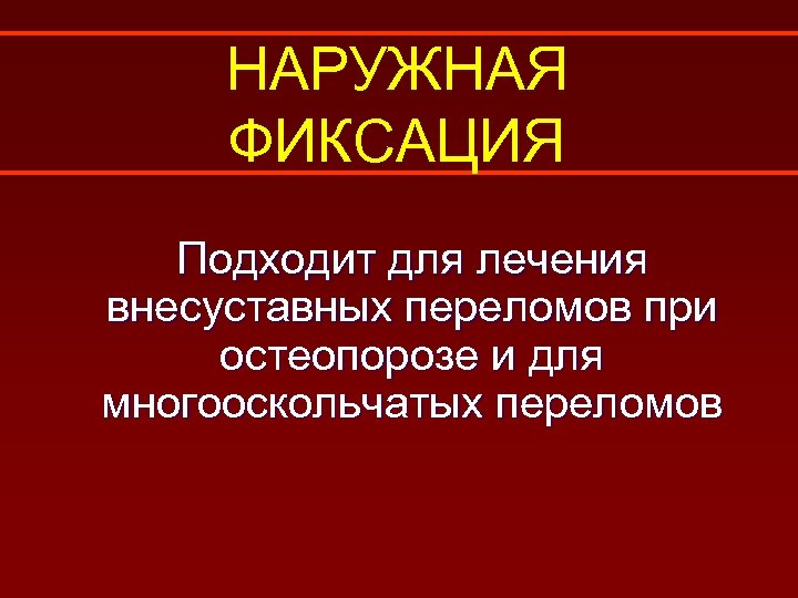 НАРУЖНАЯ ФИКСАЦИЯ Подходит для лечения внесуставных переломов при остеопорозе и для многооскольчатых переломов 