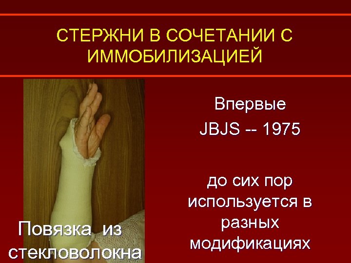 СТЕРЖНИ В СОЧЕТАНИИ С ИММОБИЛИЗАЦИЕЙ Впервые JBJS -- 1975 Повязка из стекловолокна до сих
