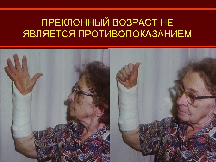ПРЕКЛОННЫЙ ВОЗРАСТ НЕ ЯВЛЯЕТСЯ ПРОТИВОПОКАЗАНИЕМ 