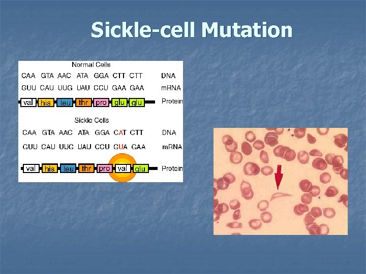 Sickle-cell Mutation 