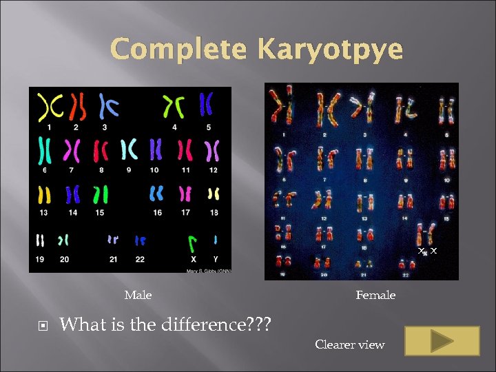 Complete Karyotpye x x Male Female What is the difference? ? ? Clearer view