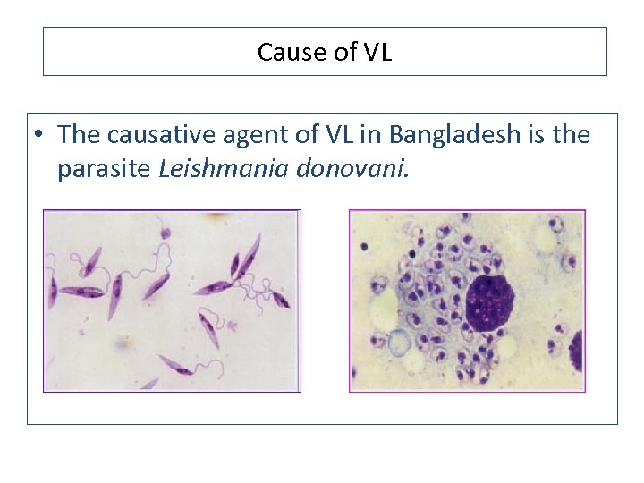 Cause of VL • The causative agent of VL in Bangladesh is the parasite