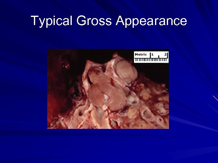 Typical Gross Appearance 