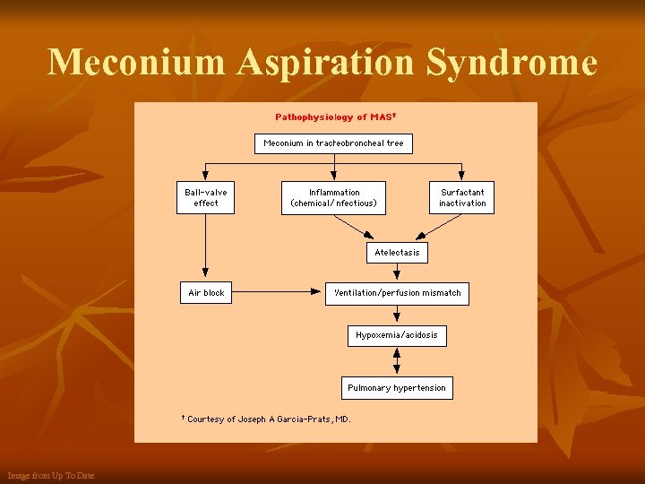 Meconium Aspiration Syndrome Image from Up To Date 