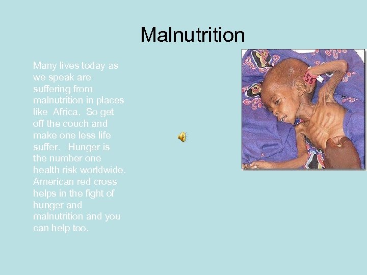 Malnutrition Many lives today as we speak are suffering from malnutrition in places like