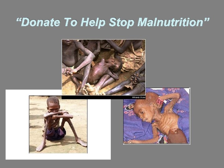 “Donate To Help Stop Malnutrition” 