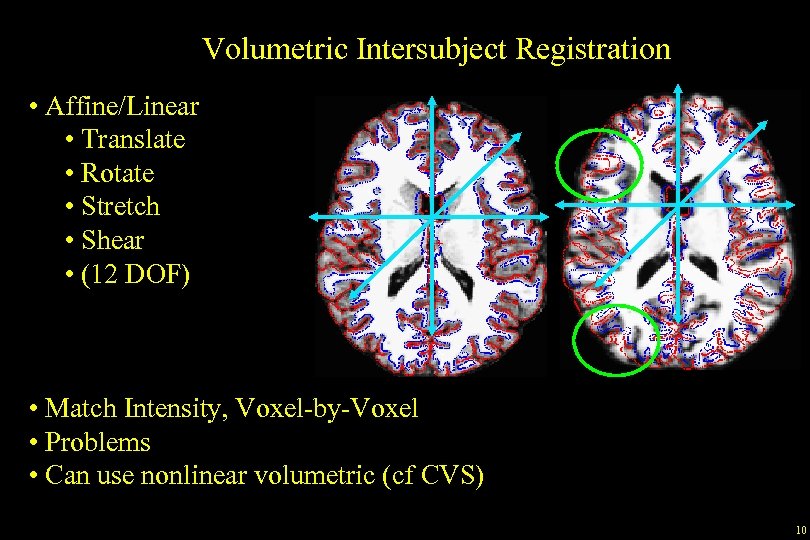 Volumetric Intersubject Registration • Affine/Linear • Translate • Rotate • Stretch • Shear •
