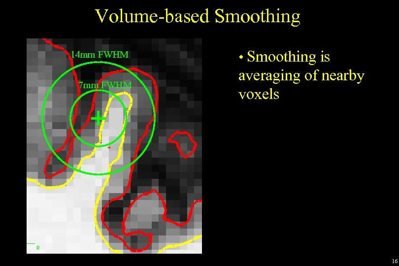 Volume-based Smoothing 14 mm FWHM 7 mm FWHM • Smoothing is averaging of nearby