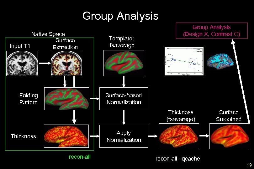 Group Analysis Native Space Surface Input T 1 Extraction Folding Pattern Template: fsaverage Group