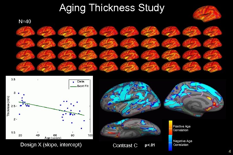 Aging Thickness Study N=40 Positive Age Correlation Design X (slope, intercept) Contrast C p<.