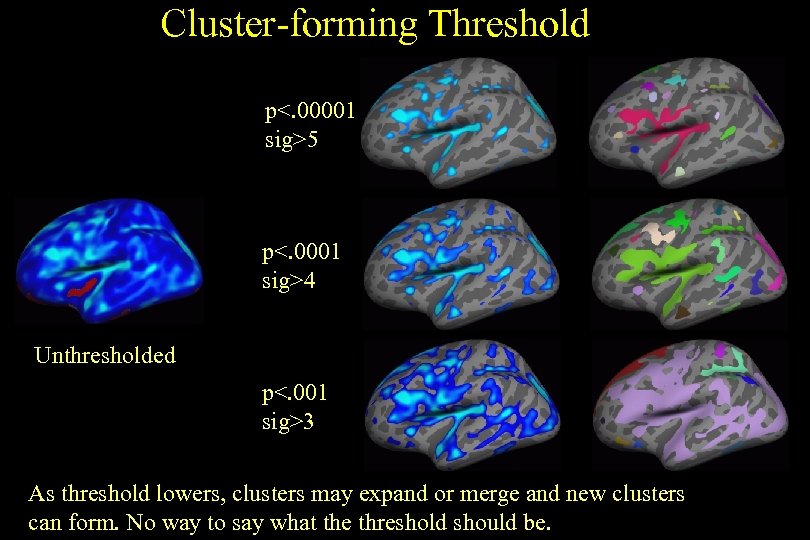 Cluster-forming Threshold p<. 00001 sig>5 p<. 0001 sig>4 Unthresholded p<. 001 sig>3 As threshold