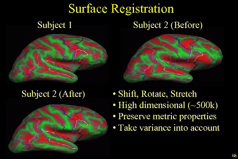Surface Registration Subject 1 Subject 2 (Before) Subject 2 (After) • Shift, Rotate, Stretch