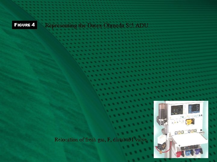 FIGURE 4 Representing the Datex-Ohmeda S/5 ADU Relocation of fresh gas, F, distal to