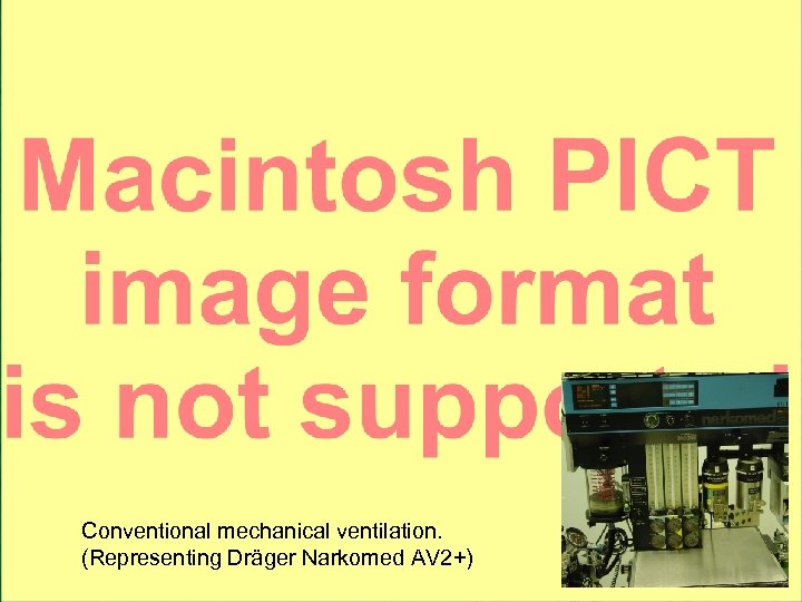 Conventional mechanical ventilation. (Representing Dräger Narkomed AV 2+) 