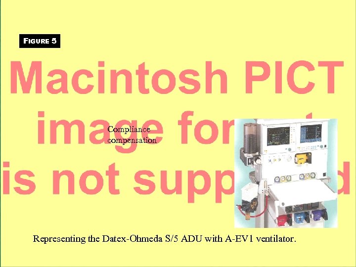 FIGURE 5 Compliance compensation Representing the Datex-Ohmeda S/5 ADU with A-EV 1 ventilator. 