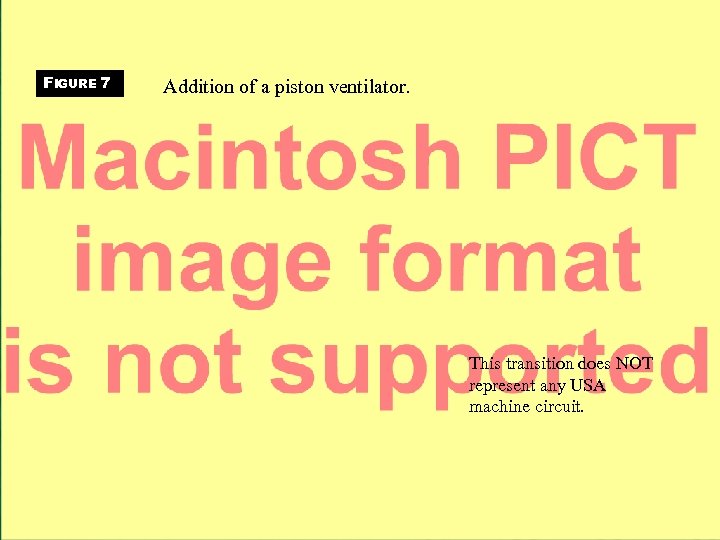 FIGURE 7 Addition of a piston ventilator. This transition does NOT represent any USA