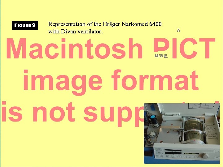 FIGURE 9 Representation of the Dräger Narkomed 6400 with Divan ventilator. M/S-E A 