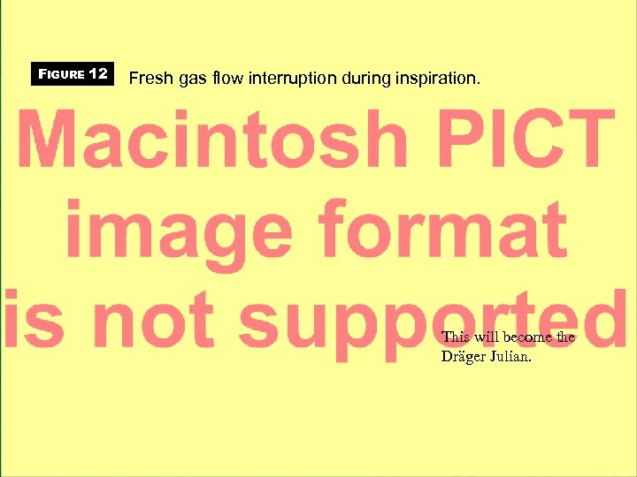 FIGURE 12 Fresh gas flow interruption during inspiration. This will become the Dräger Julian.