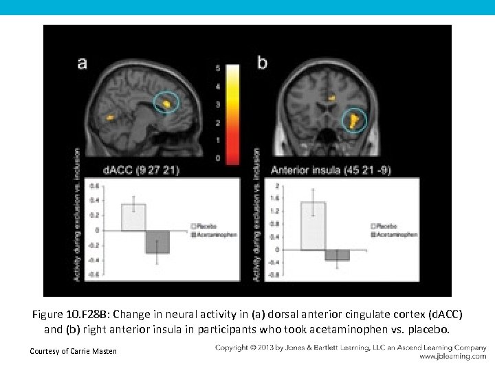 Figure 10. F 28 B: Change in neural activity in (a) dorsal anterior cingulate