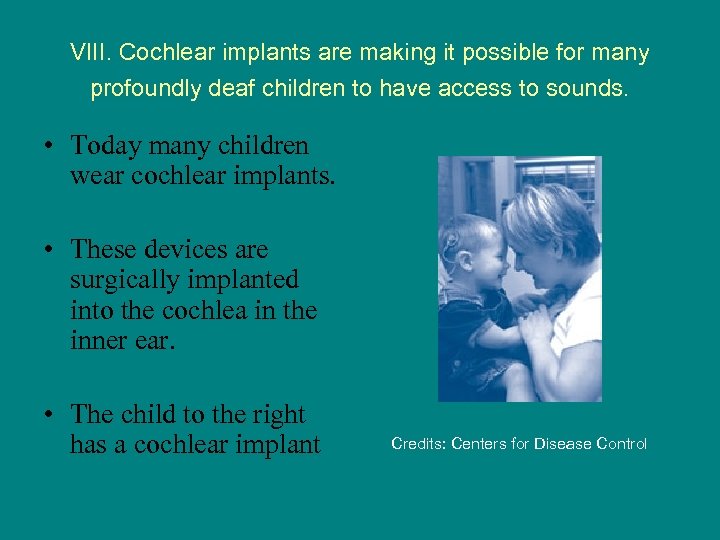 VIII. Cochlear implants are making it possible for many profoundly deaf children to have