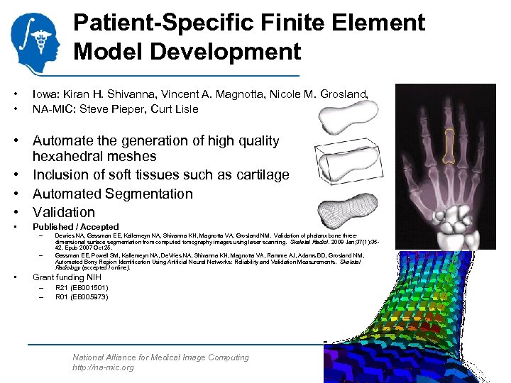 Patient-Specific Finite Element Model Development • • Iowa: Kiran H. Shivanna, Vincent A. Magnotta,