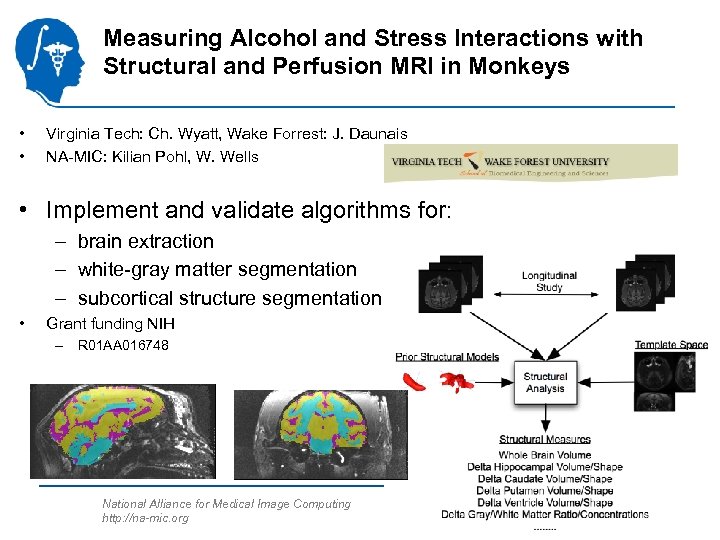 Measuring Alcohol and Stress Interactions with Structural and Perfusion MRI in Monkeys • •