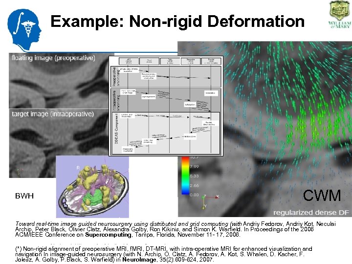 Example: Non-rigid Deformation BWH CWM Toward real-time image guided neurosurgery using distributed and grid