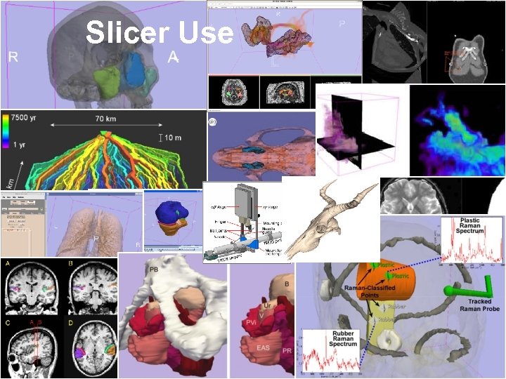 Slicer Use Image Gallery 6 National Alliance for Medical Image Computing http: //na-mic. org