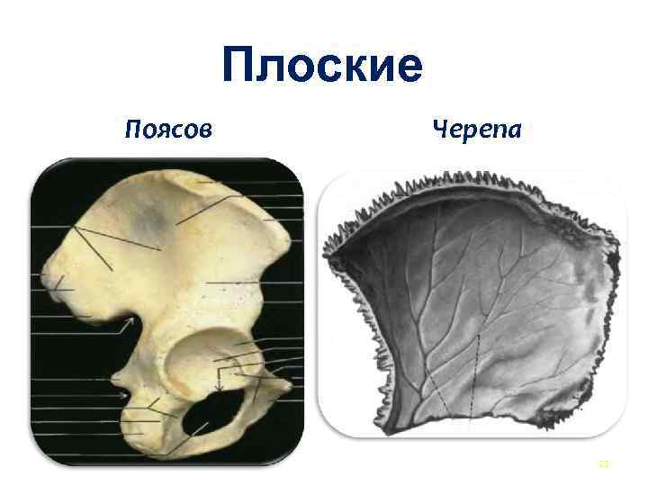  Плоские Поясов Черепа 11 