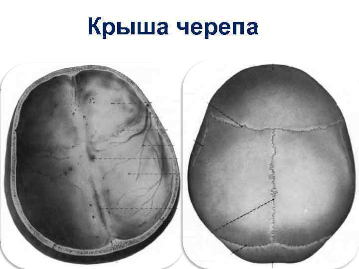 Кости свода черепа. Швы свода черепа анатомия. Кости свода черепа анатомия. Свод крыша черепа латынь. Кости свода и основания черепа.