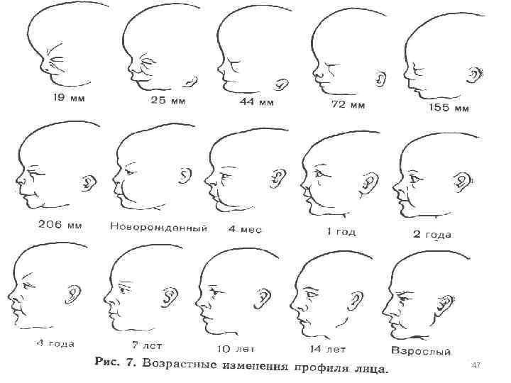 До скольки формируется человек. Форма черепа у новорожденного по месяцам. Меняется ли форма черепа с возрастом у детей. Меняется ли форма черепа с возрастом у новорожденных. Формы черепа человека в норме.