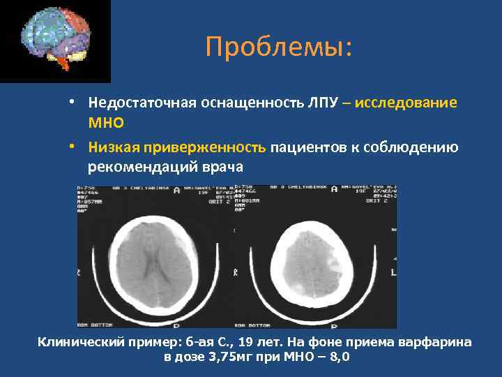  Проблемы: • Недостаточная оснащенность ЛПУ – исследование МНО • Низкая приверженность пациентов к