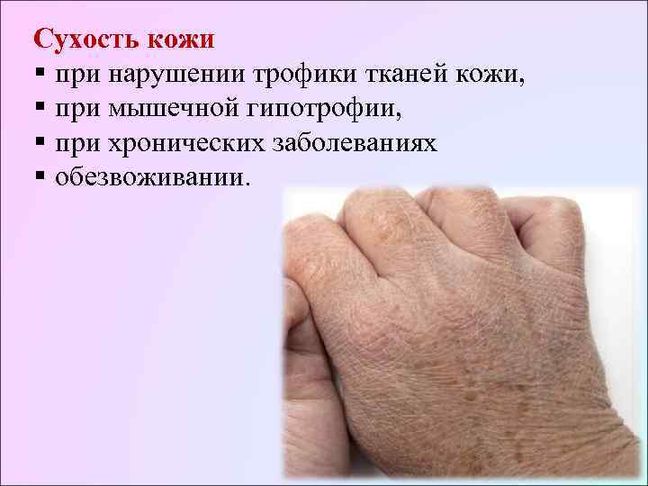 Сухость кожи § при нарушении трофики тканей кожи, § при мышечной гипотрофии, § при