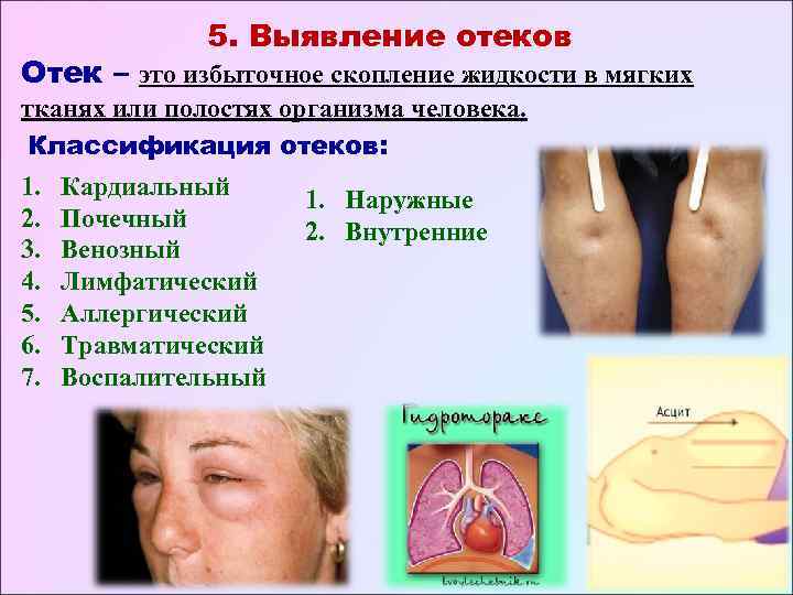 Карта сестринской оценки состояния пациента