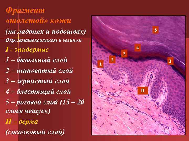 Фрагмент «толстой» кожи (на ладонях и подошвах) 5 Окр. гематоксилином и эозином 4 I