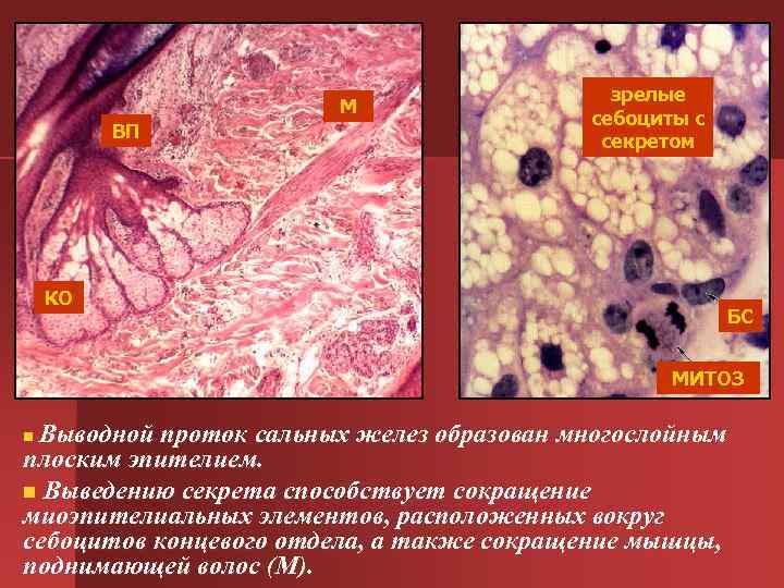  зрелые М себоциты с ВП секретом КО БС МИТОЗ n. Выводной проток сальных