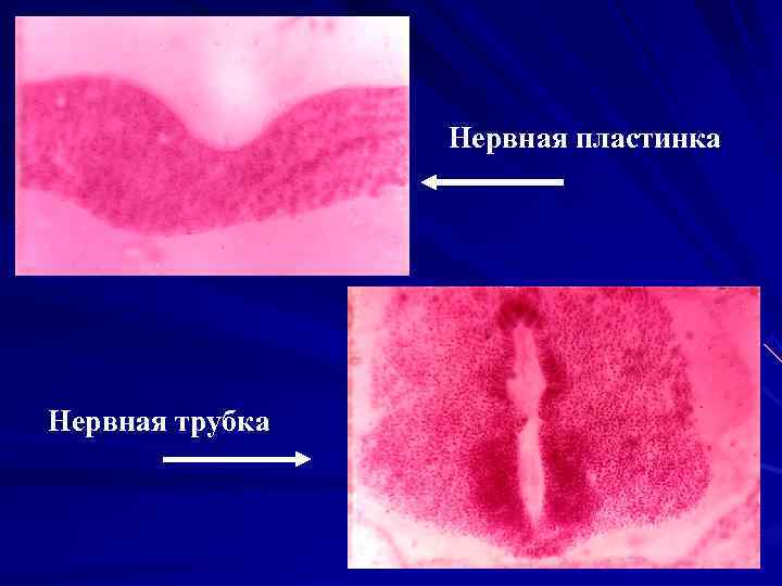  Нервная пластинка Нервная трубка 