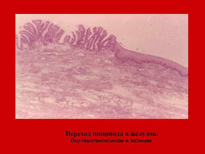 Переход пищевода в желудок. Окр гематоксилином и эозином. 