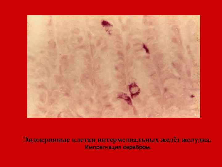 Эндокринные клетки интермедиальных желёз желудка. Импрегнация серебром. 