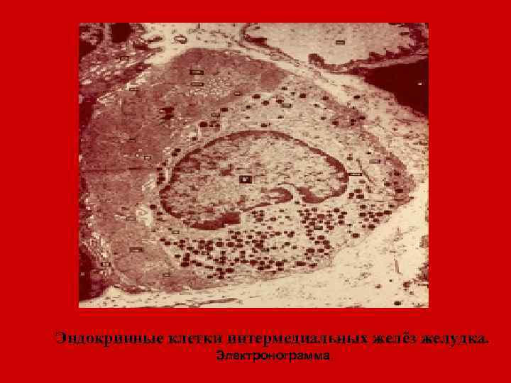 Эндокринные клетки интермедиальных желёз желудка. Электронограмма. 
