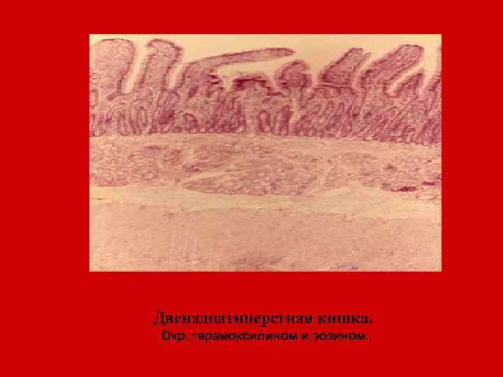 Двенадцатиперстная кишка. Окр. герамоксилином и эозином. 