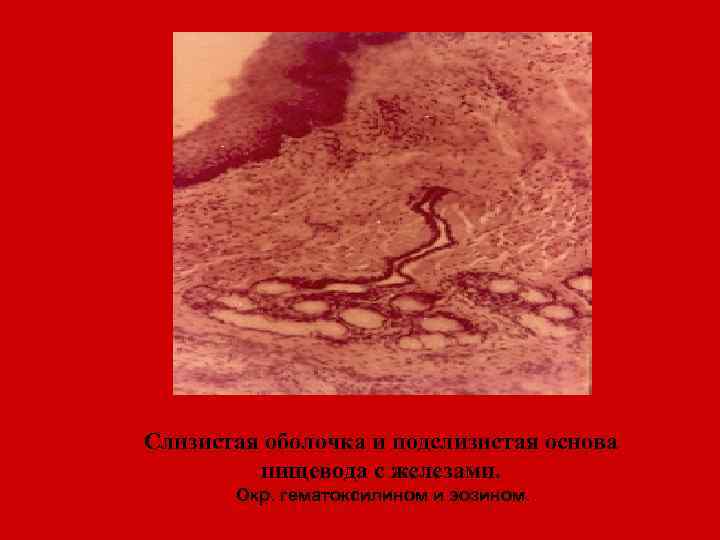 Слизистая оболочка и подслизистая основа пищевода с железами. Окр. гематоксилином и эозином. 