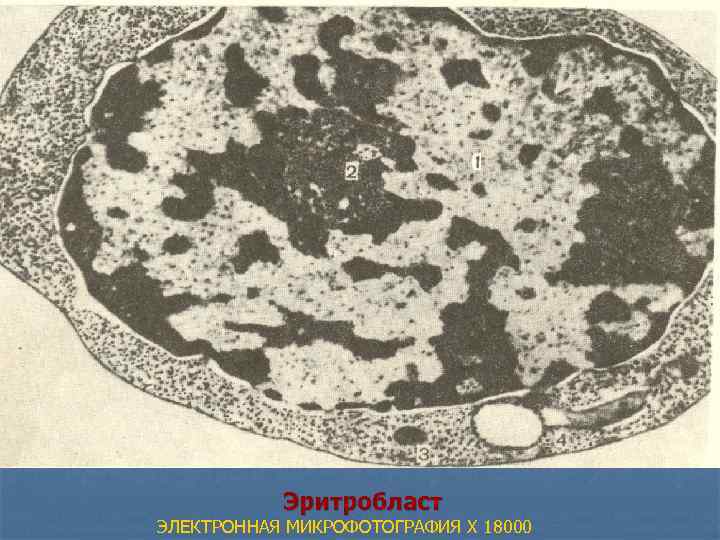  Эритробласт ЭЛЕКТРОННАЯ МИКРОФОТОГРАФИЯ X 18000 